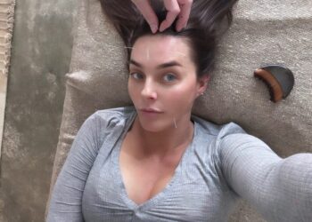 Beauty Acupuncture: The place Magnificence Meets Stability