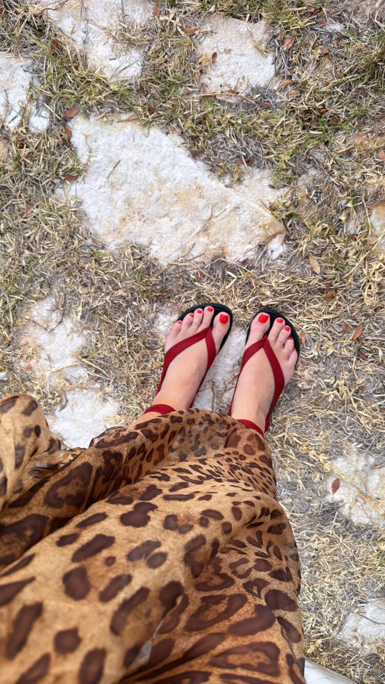 How To Cease Toes Swelling In Sizzling Climate: A Information to Summer season Swelling