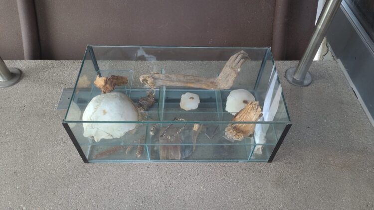 ‘Tis the season for bins of physique elements – The Historical past Weblog