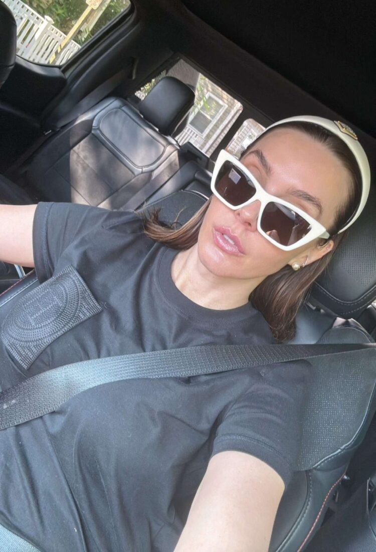 Does Niacinamide Assist with Zits Scars? What It Can & Can’t Do