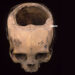 How the Incas Carried out Cranium Surgical procedure Extra Efficiently Than U.S. Civil Conflict Docs