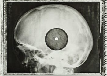 When Soviet Youth Bootlegged Western Rock Music on Discarded X-Rays: Hear Unique Audio Samples