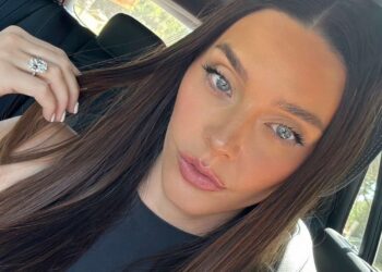 The right way to Get Rid of Hyperpigmentation Across the Mouth: Professional Suggestions