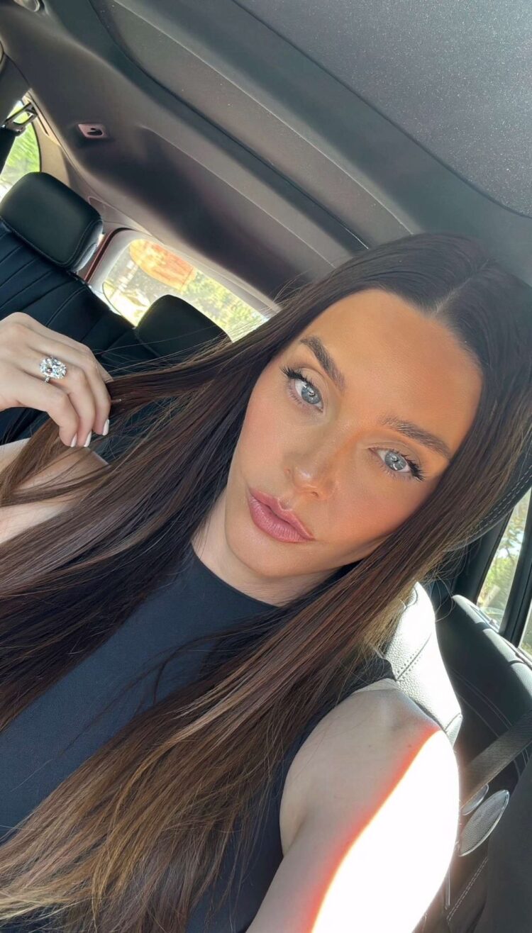 The right way to Get Rid of Hyperpigmentation Across the Mouth: Professional Suggestions