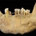 Oldest instance of restorative dentistry in Scotland present in parish church bone – The Historical past Weblog