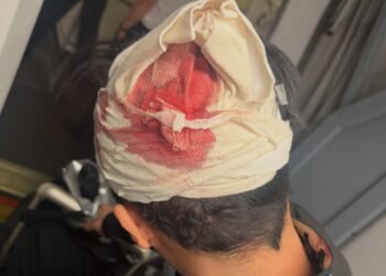 BEAUZ Member Rushed to Hospital, Will get Staples in Head After Fainting on Flight