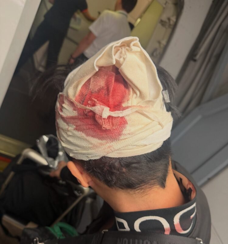 BEAUZ Member Rushed to Hospital, Will get Staples in Head After Fainting on Flight
